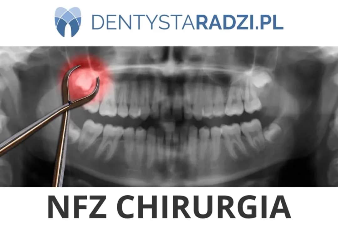 Ile kosztuje wyrwanie zęba 7? Ceny, NFZ i ukryte koszty
