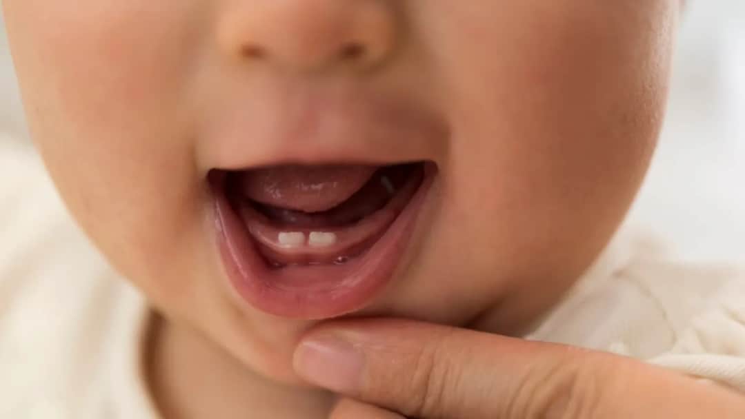 Ból dziąseł u niemowlaka? Sprawdzone sposoby na ulgę w ząbkowaniu