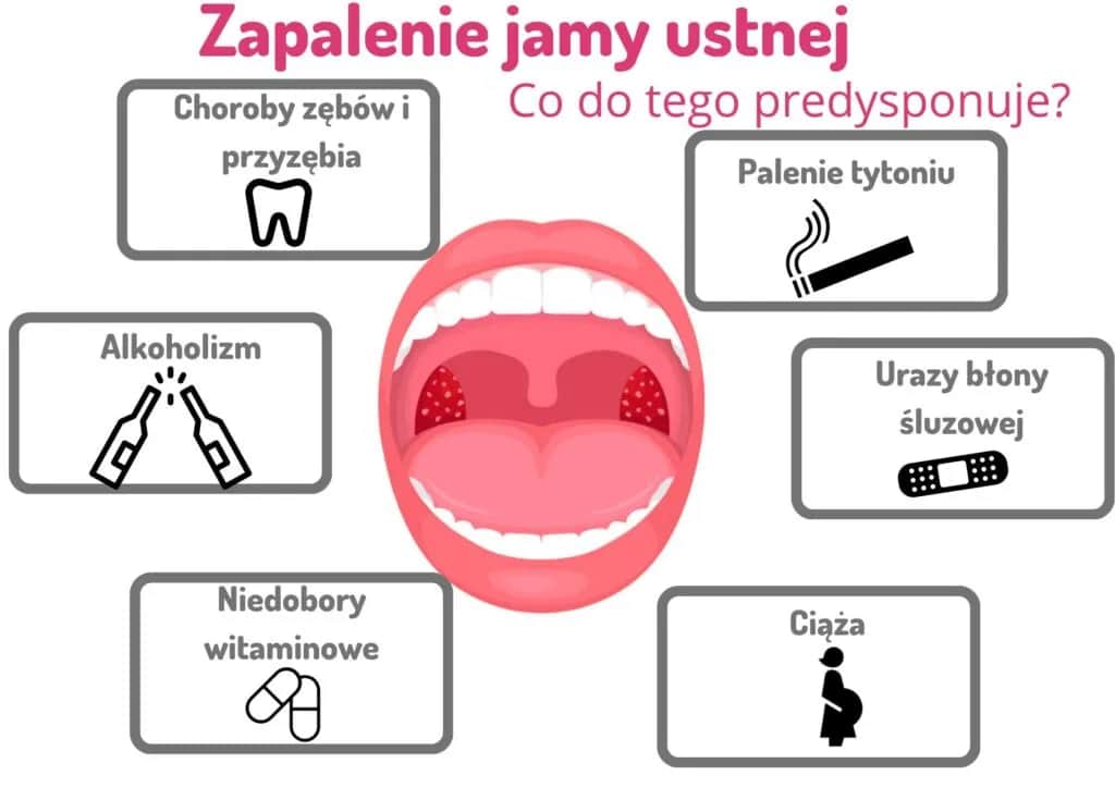 Zapalenie jamy ustnej: Szybkie sposoby, leki i kiedy iść do lekarza