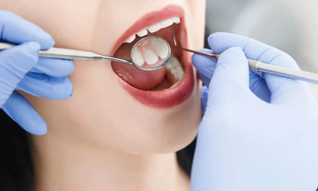 Skierowanie do dentysty: kiedy jest potrzebne? NFZ vs. prywatnie