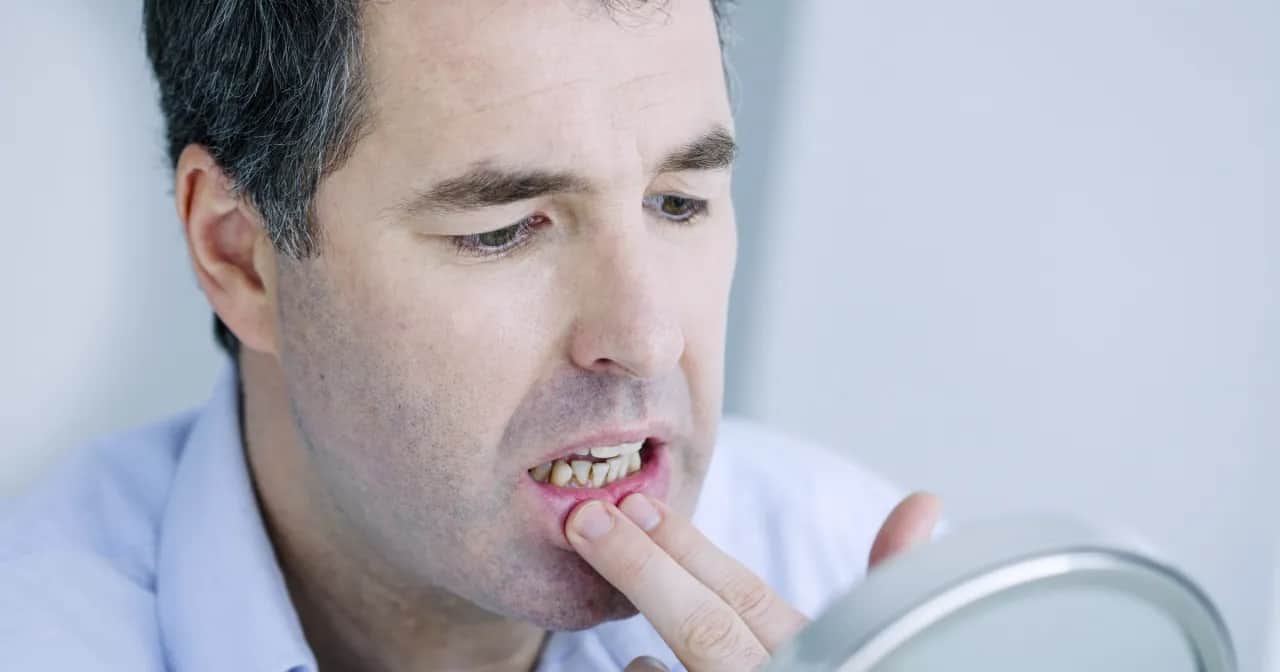 Ból dziąseł: Przyczyny, domowe sposoby i kiedy iść do dentysty