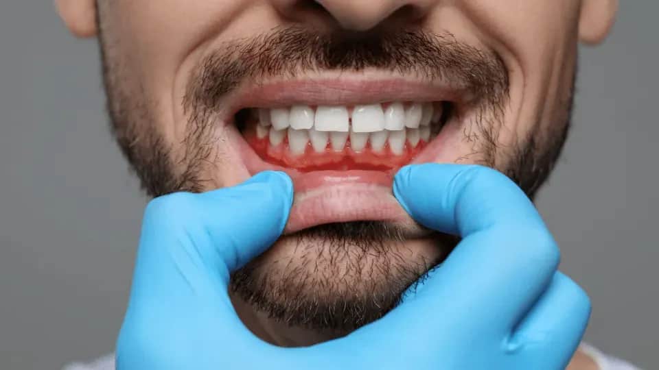 Jak rozpoznać zdrowe dziąsła? Sprawdź 4 kroki i sygnały alarmowe